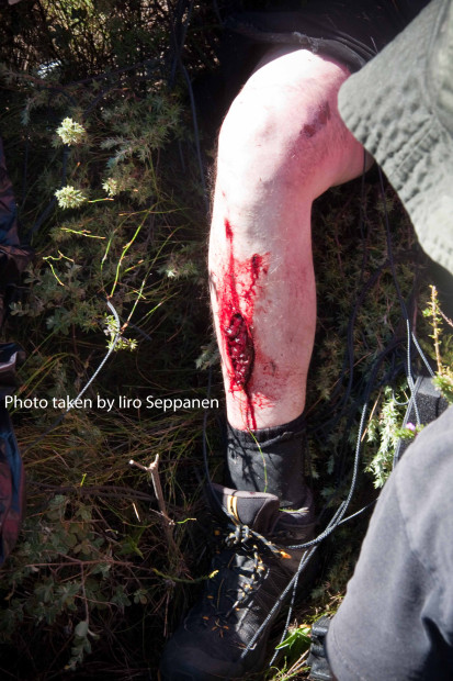 Jeb Corliss injury after a brush with a rock wall...at over 100mph