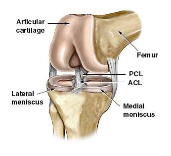 image showing ACL that Lindsey partially tore yesterday.
