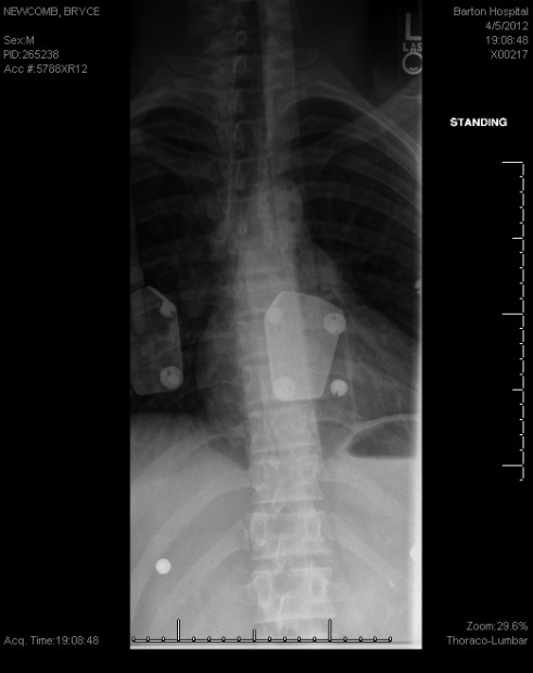 Broken back located next to plates