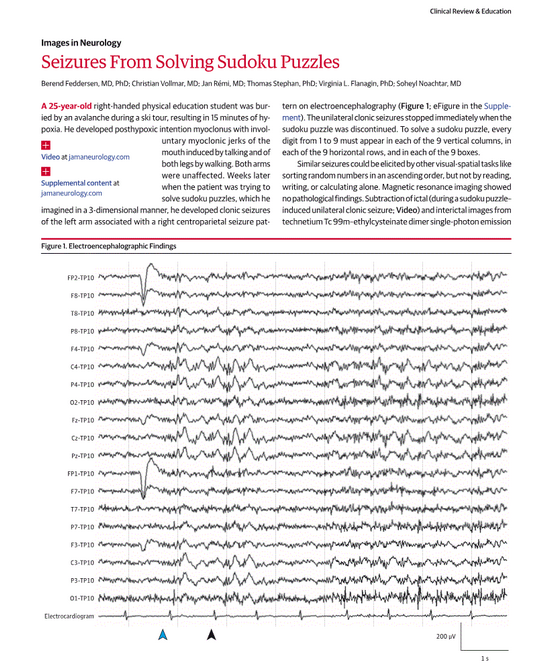 Abstract and brain wave patterns of this Avalanche victim's Sudoku caused seizures. 