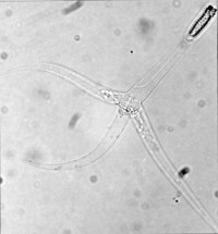 Tetracapsuloides bryosalmonae star shaped spore