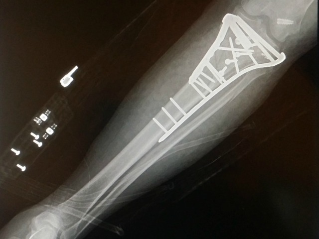 Elma's injury. // photo: Stu Press