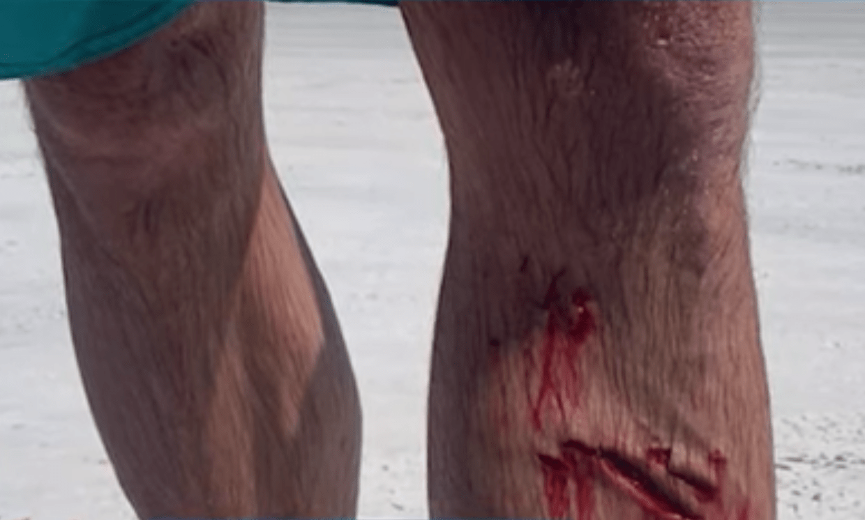 shark, attack, Florida, surfer, surf