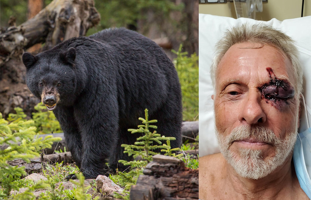 72-year-old man attacked by bear along trail, officials say