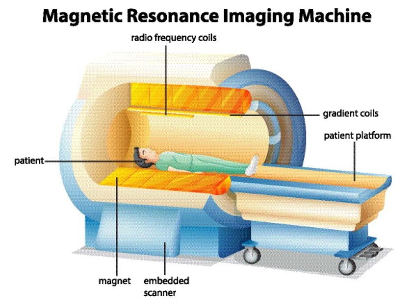 MRI MCL tear treatment knee surgeon adelaide recovery time