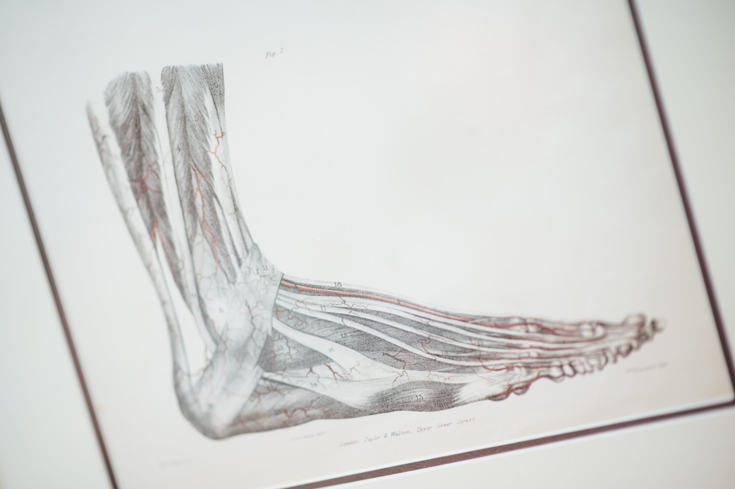 foot x-ray