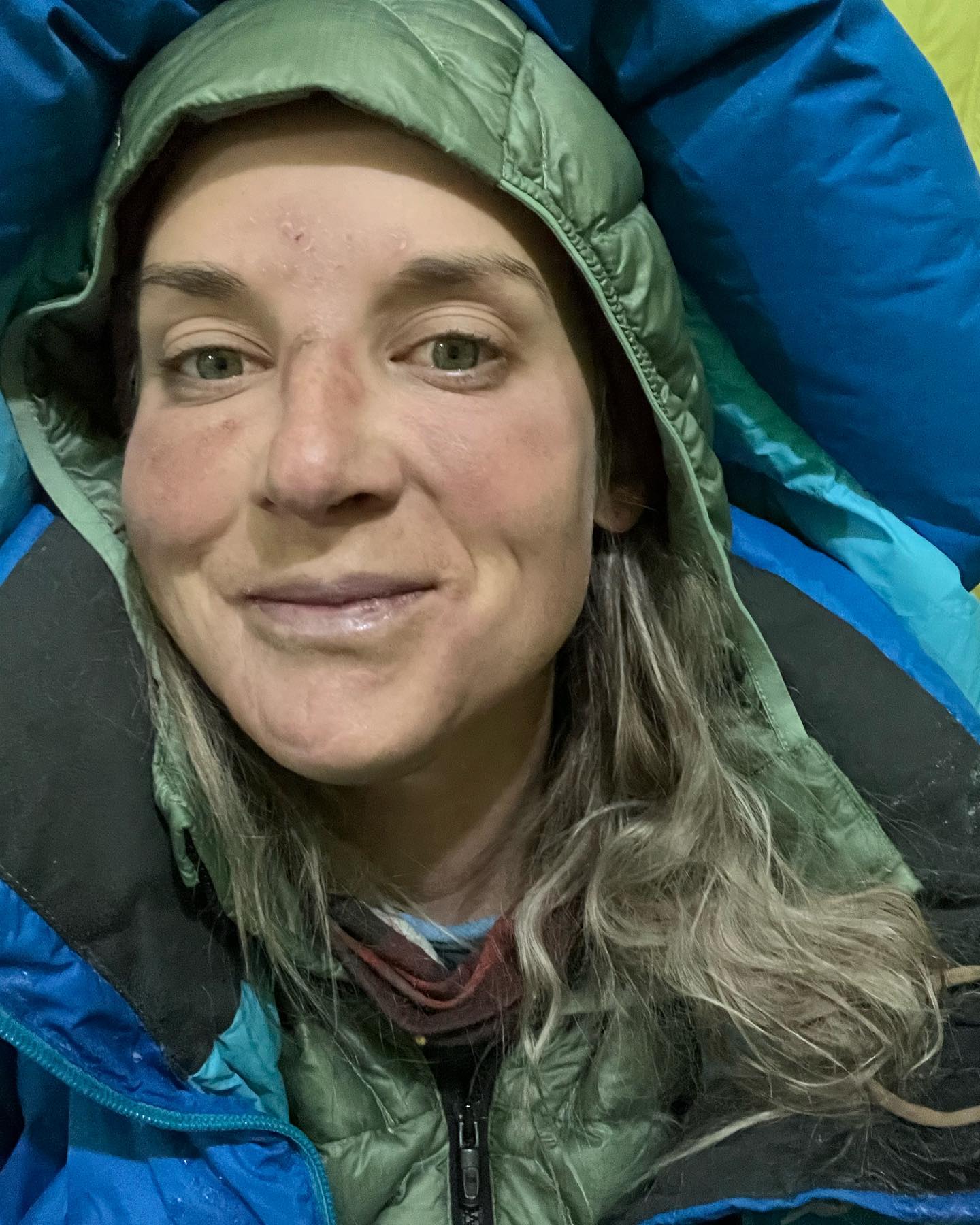 Kirstie Ennis Is Climbing the Highest Mountains in the World—While Wearing  a Prosthetic Leg