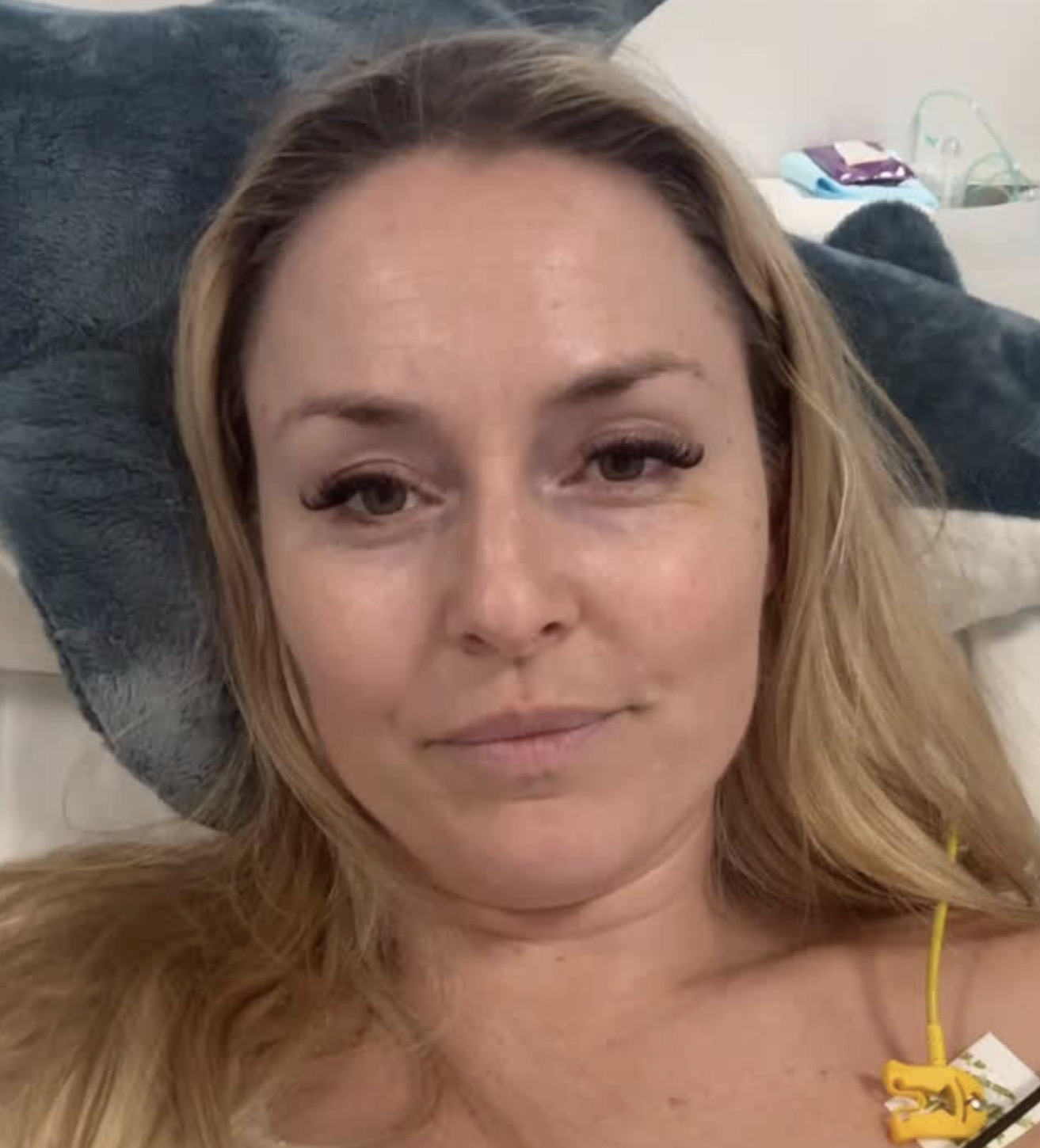 Lindsey Vonn: "The Ride Was Worth the Fall" After Successful 4th Surgery in Italy - SnowBrains